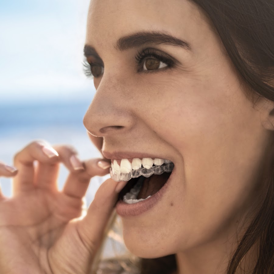 Invisalign - Removível